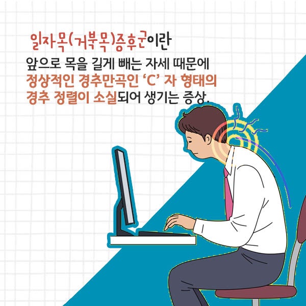 거북목 일자목 디스크로 진행되기전에 자세교정운동과 추나요법으로 체형교정하세요!!