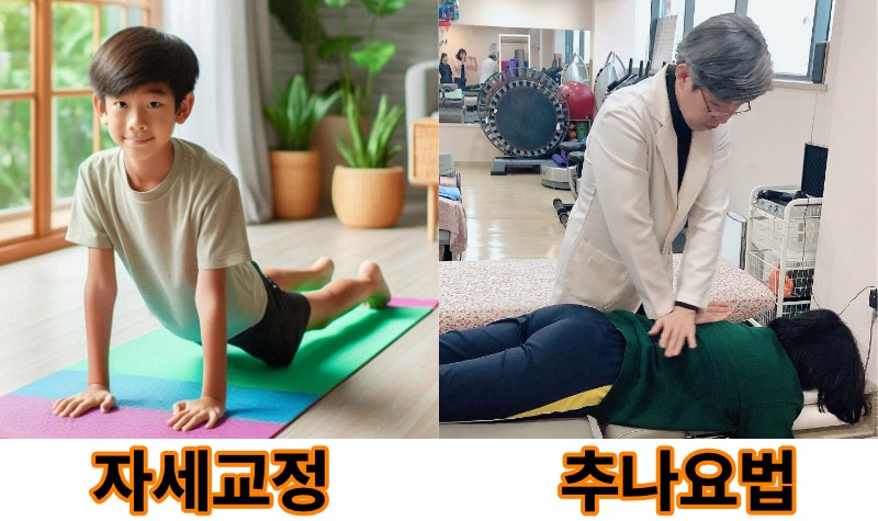 거북목 일자목 디스크로 진행되기전에 자세교정운동과 추나요법으로 체형교정하세요!!