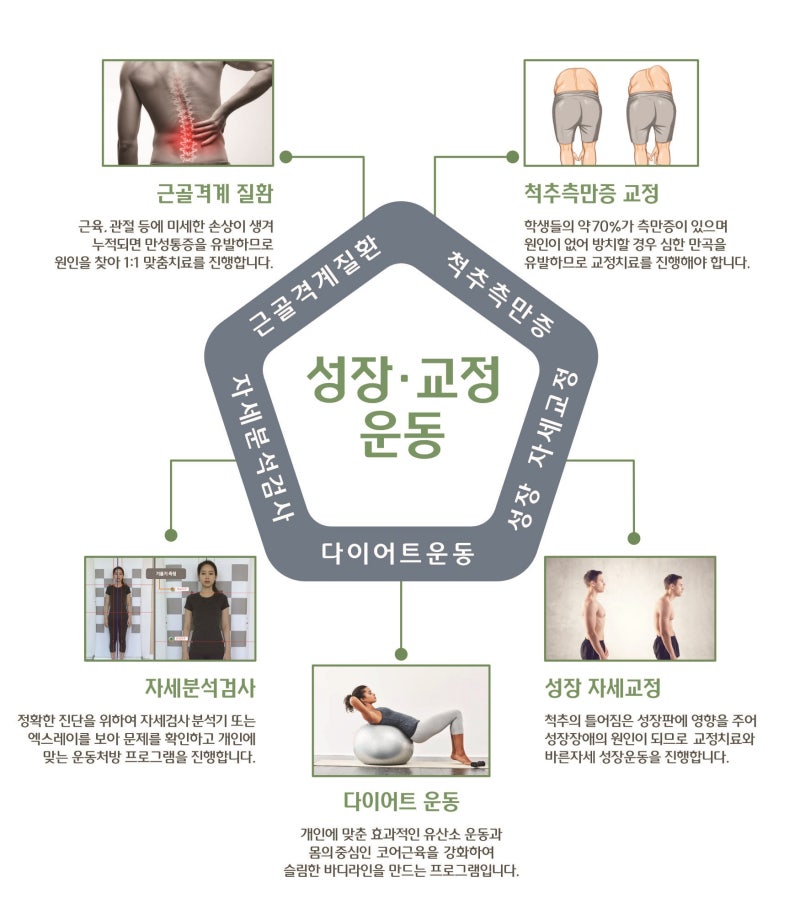 거북목 일자목 디스크로 진행되기전에 자세교정운동과 추나요법으로 체형교정하세요!!