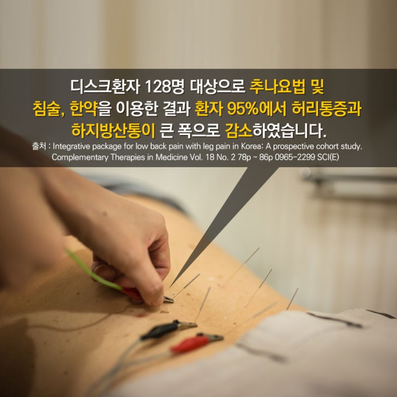 추간판탈출증으로 허리통증 다리저림 증상이 있으시면 무조건 수술하지마시고