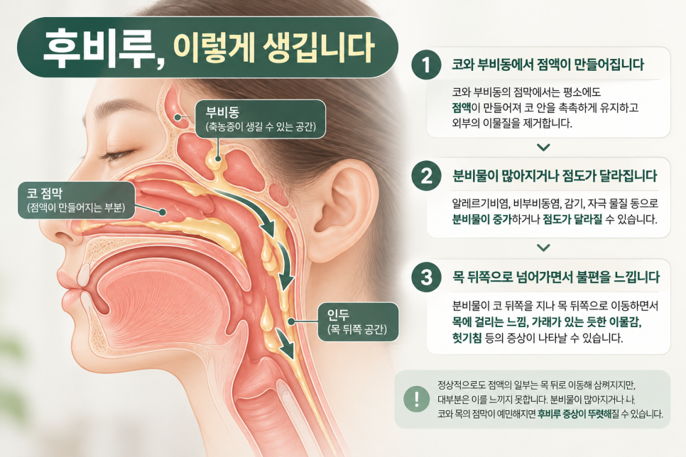 노원 후비루, 콧물이 목 뒤로 넘어가고 헛기침이 계속된다면? 관련 이미지 2
